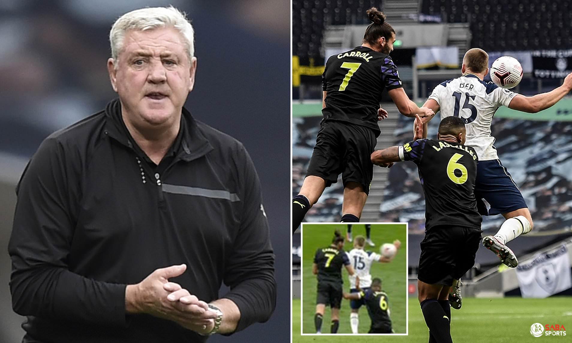 Steve Bruce lên tiếng phản đối luật bóng chạm tay