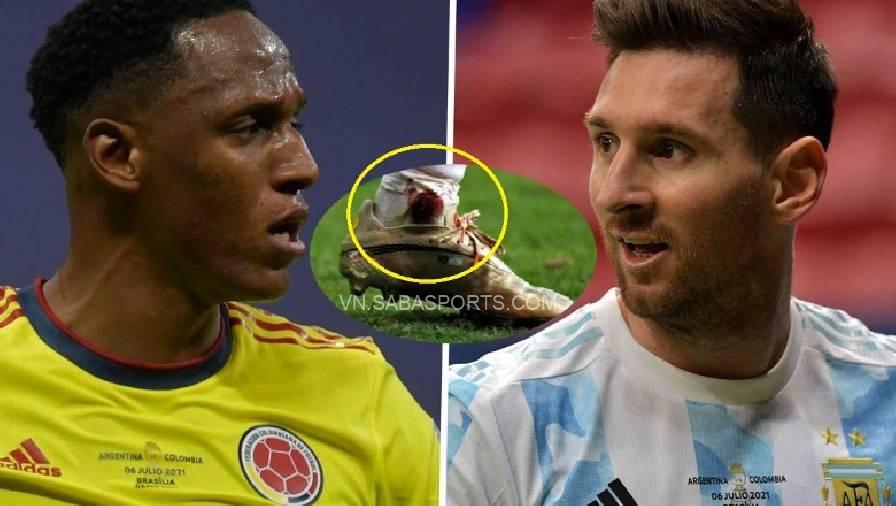 Trước đó Mina đã có những tác động khiến Messi bị chấn thương trong trận đấu này