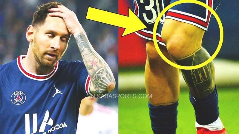 Cơn đau của Messi đã bị tái phát ở PSG